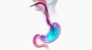 위내시경 검사 기전의 3D 의학 일러스트레이션